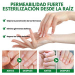 Tratamiento Anti hongo para las uñas NAIL FUNGUS – Prevención y Alivio Rápido AHORA2x1