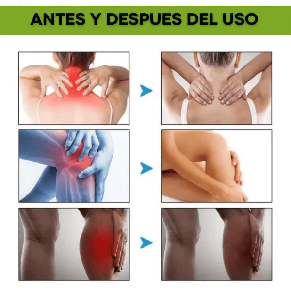 COMPRE 1 LLEVE 2 BEEVANA - Crema De veneno de abeja Multifuncional + ENVIO GRATIS 🎁